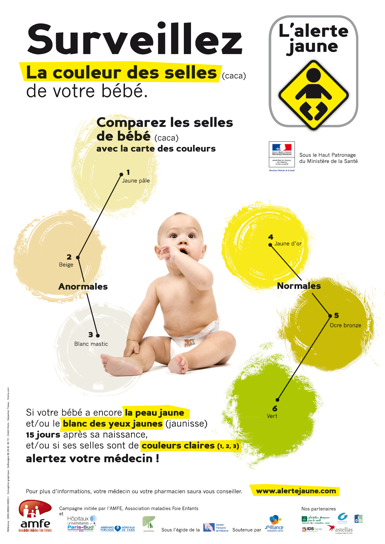 AMFE - Aletre jaune : surveillez les couleurs des selles de votre bébé