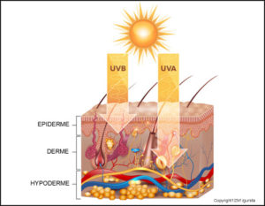 Allergie au soleil : symptômes, prévention et traitements
