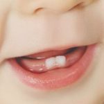 Poussée dentaire et homéopathie