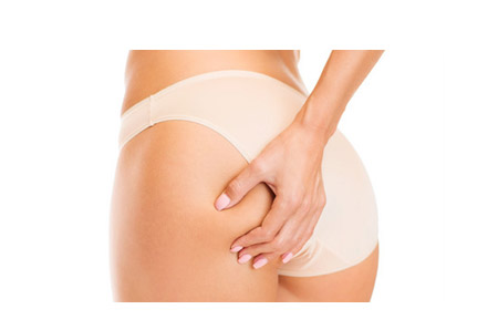 Eliminer la cellulite