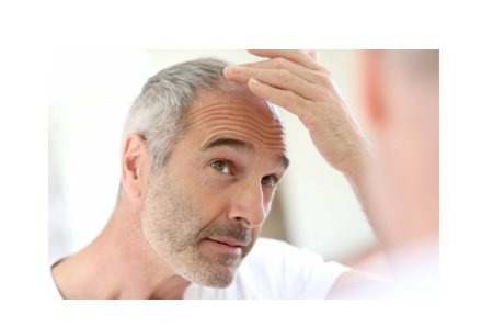 La perte de cheveux est un problème courant qui touche aussi bien les hommes que les femmes.